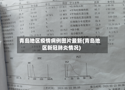 青岛地区疫情病例图片最新(青岛地区新冠肺炎情况)-第1张图片