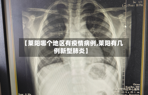 【莱阳哪个地区有疫情病例,莱阳有几例新型肺炎】-第1张图片