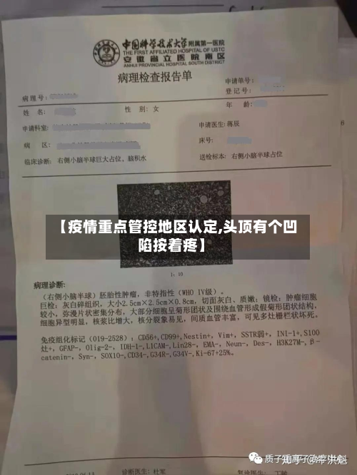 【疫情重点管控地区认定,头顶有个凹陷按着疼】-第1张图片