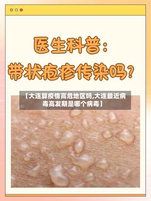 【大连算疫情高危地区吗,大连最近病毒高发期是哪个病毒】-第1张图片