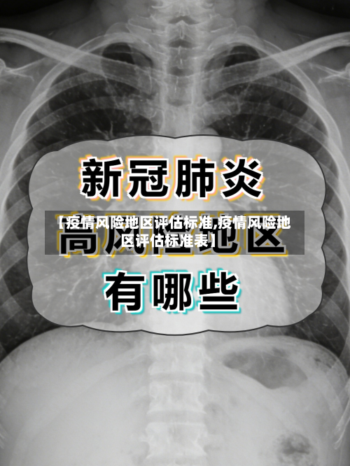 【疫情风险地区评估标准,疫情风险地区评估标准表】-第1张图片