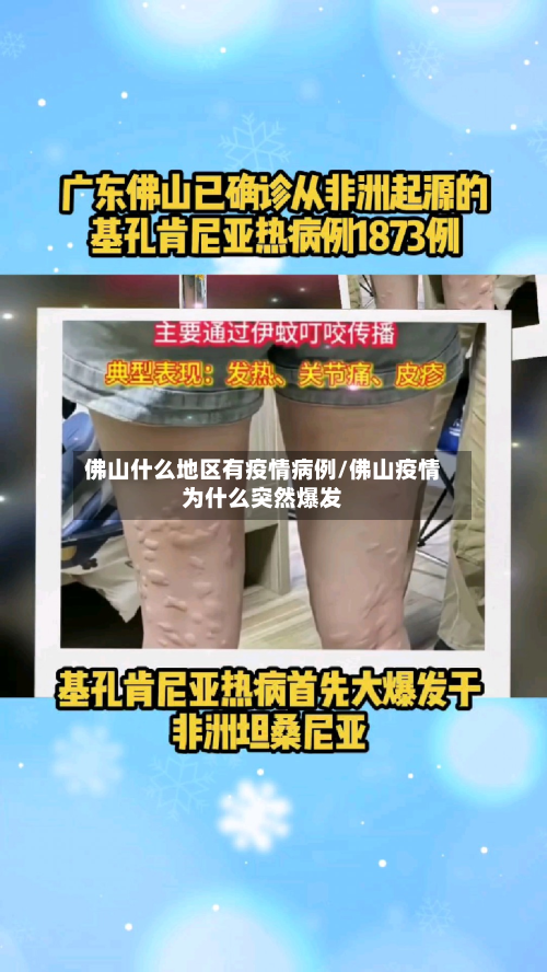 佛山什么地区有疫情病例/佛山疫情为什么突然爆发-第1张图片