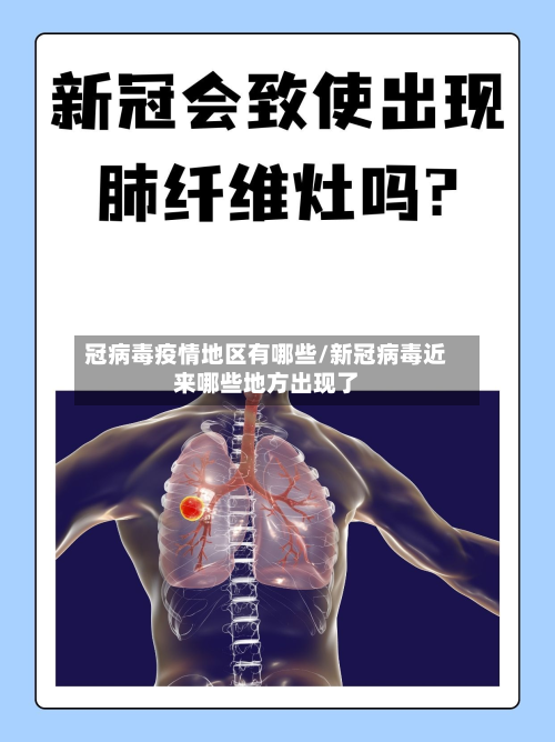 冠病毒疫情地区有哪些/新冠病毒近来哪些地方出现了-第1张图片
